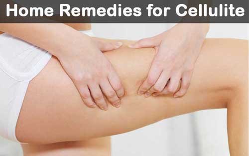 natural home remedies to get rid of cellulite