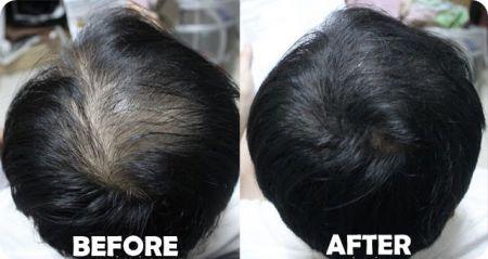 stimulate hair growth tips